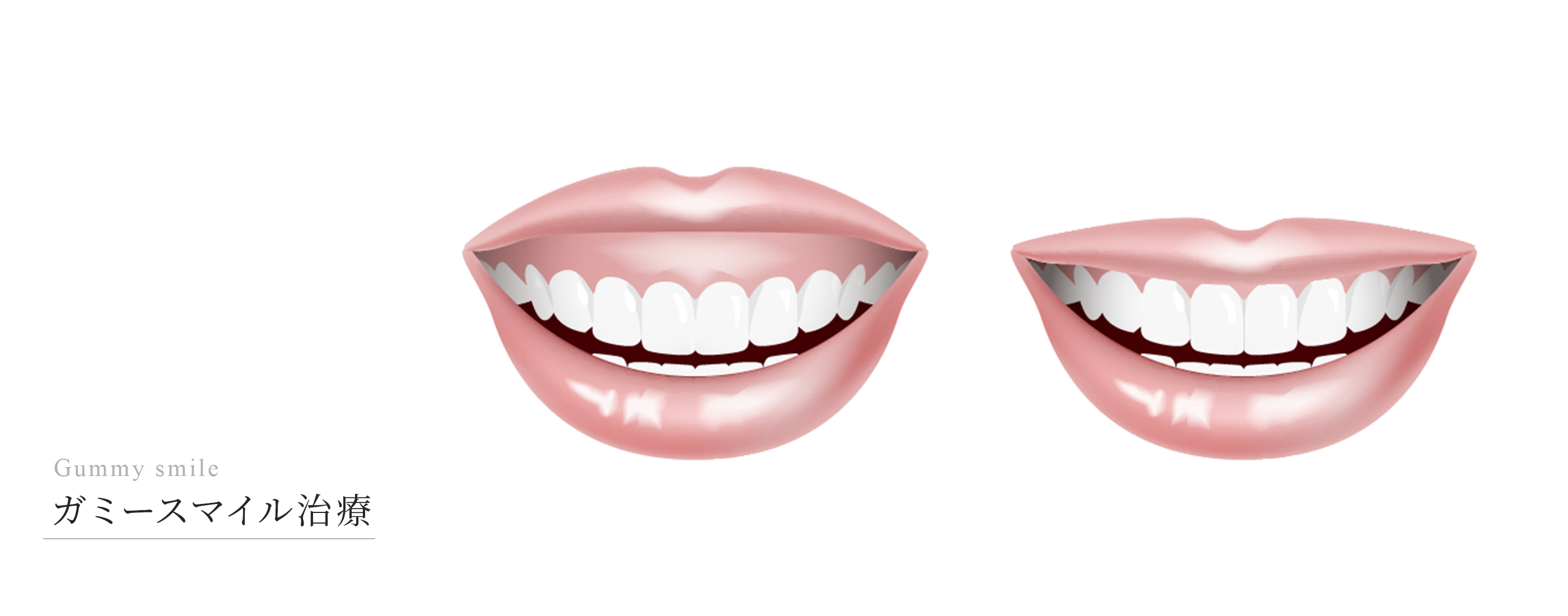 キービジュアル